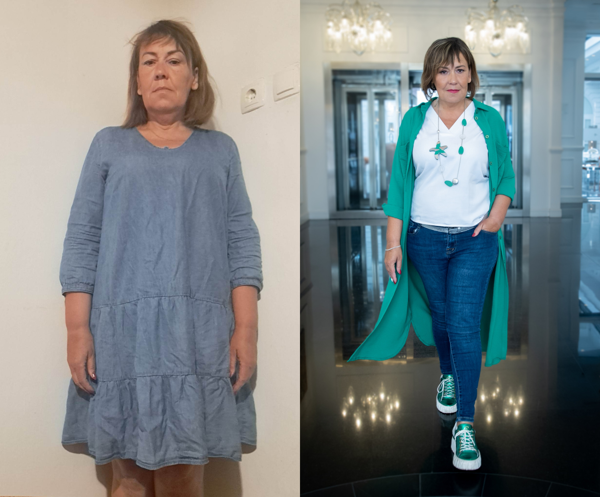 Előtte-utána fotó