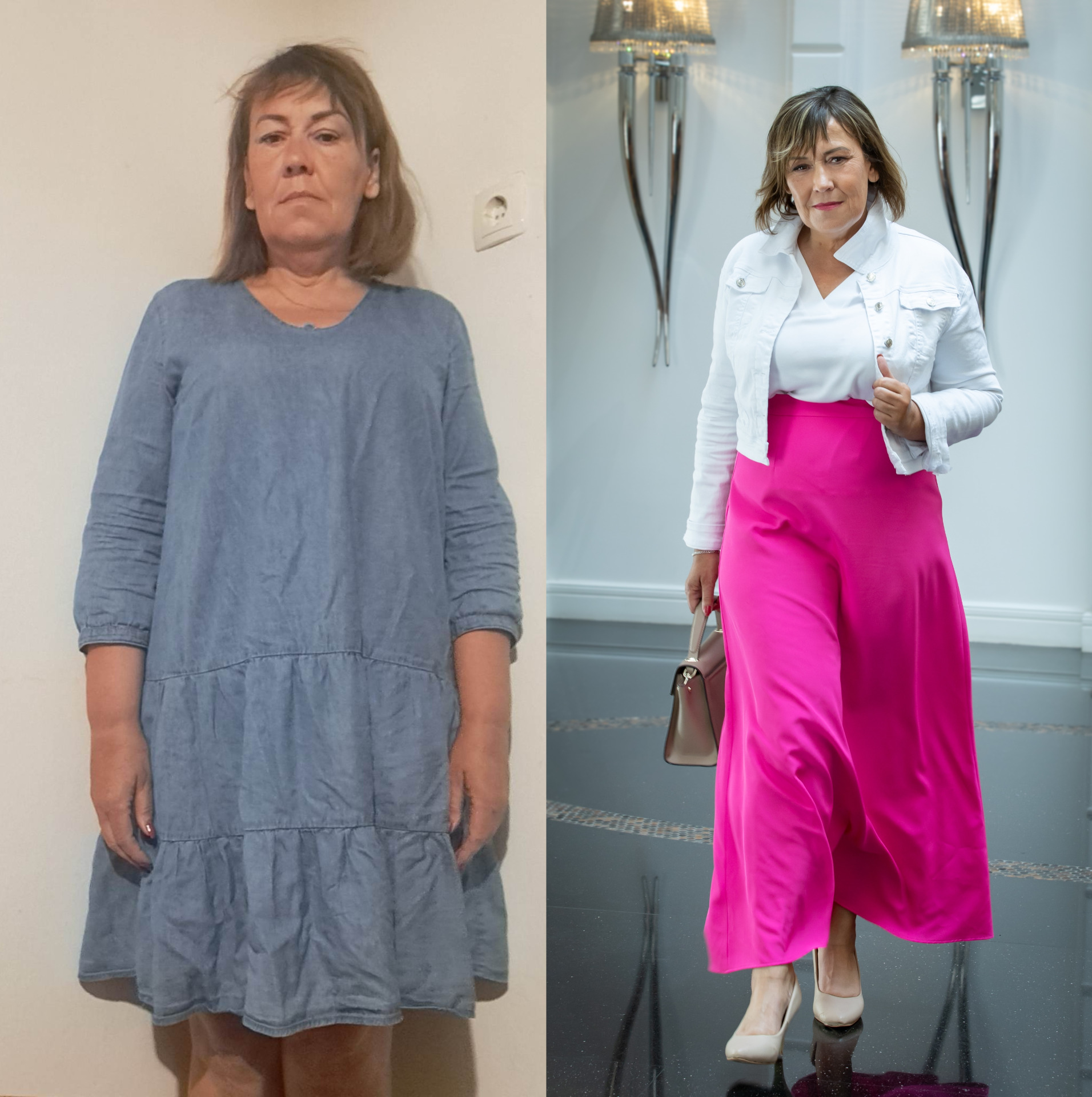 Előtte-utána fotó