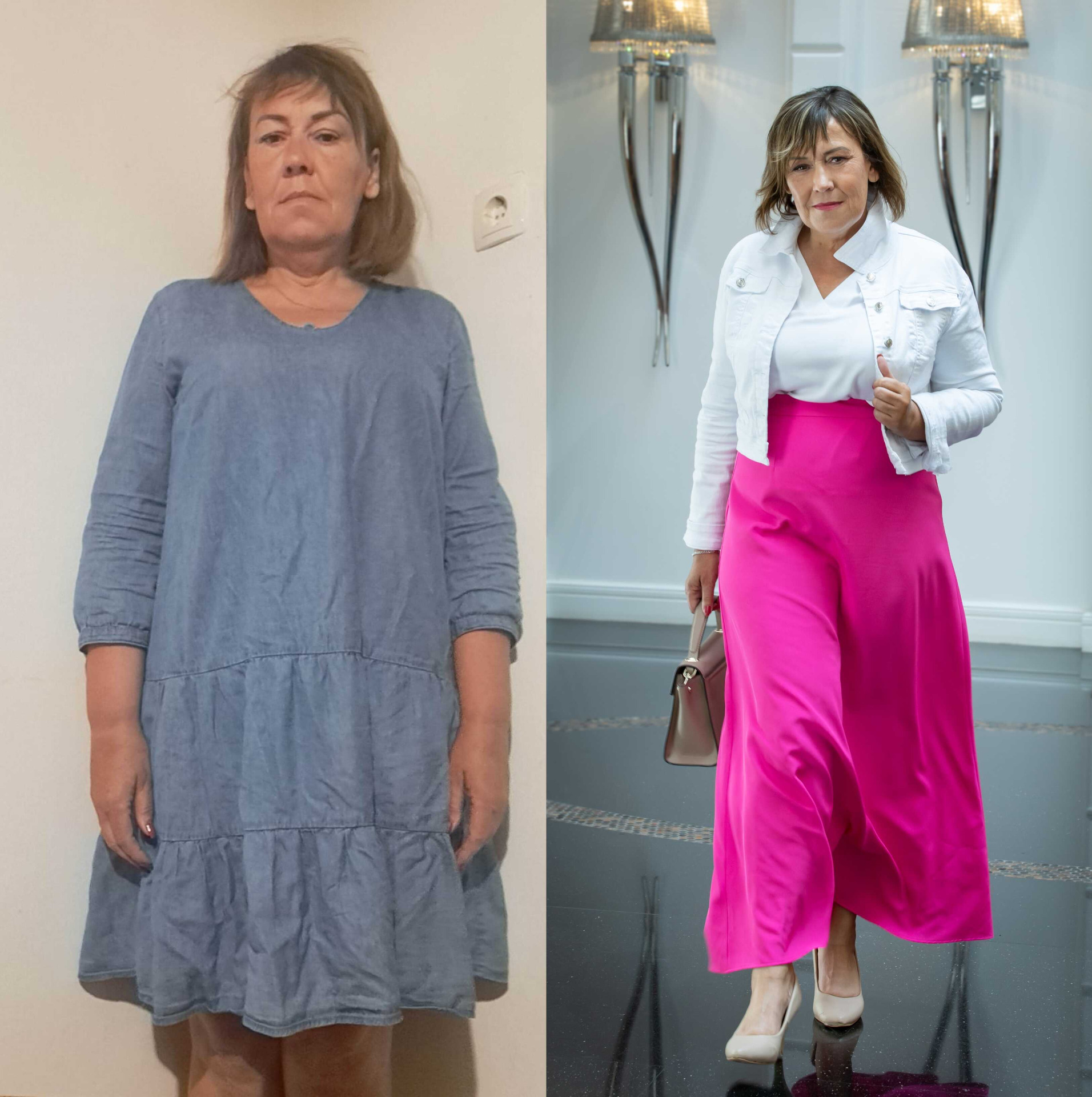 Előtte-utána fotó